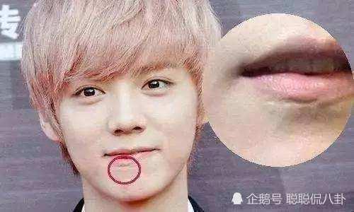 脸烧伤的明星,勇敢面对挑战的他们